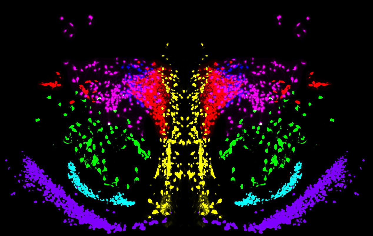 Laboratory Visualizes the Brain Circuits Involved in Anxiety and Aggressiveness